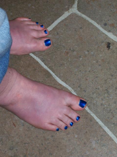 2 My Blue Toe Nails - 100_0766