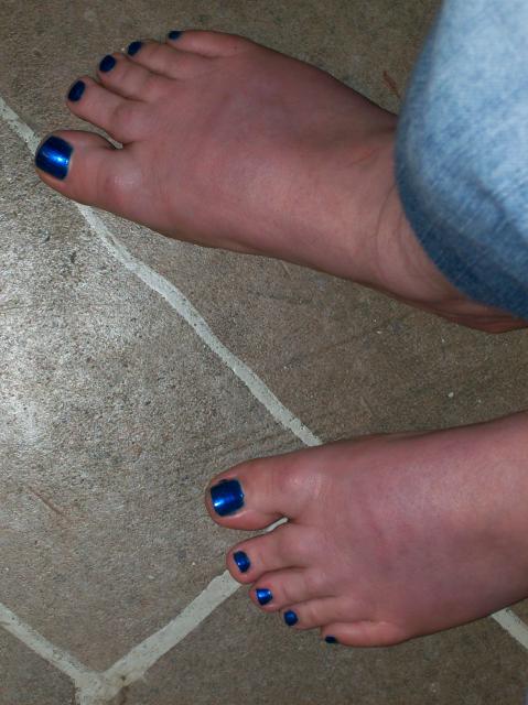 3 My Blue Toe Nails - 100_0762