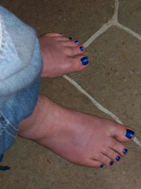 3 My Blue Toe Nails - 100_0764