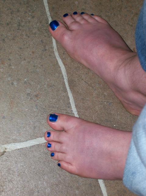 3 My Blue Toe Nails - 100_0767