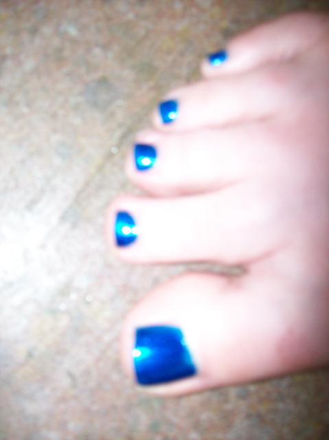 3 My Blue Toe Nails - 100_0768