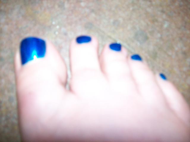 3 My Blue Toe Nails - 100_0769