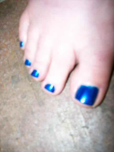 4 My Blue Toe Nails - 100_0770
