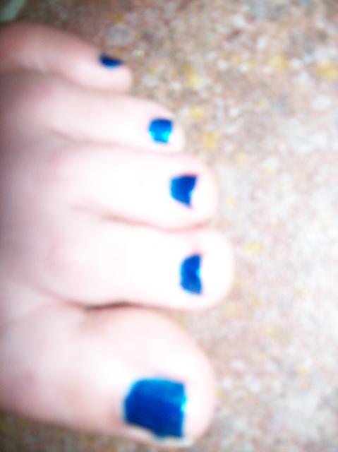 4 My Blue Toe Nails - 100_0771