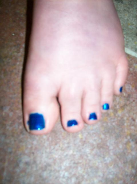 4 My Blue Toe Nails - 100_0772